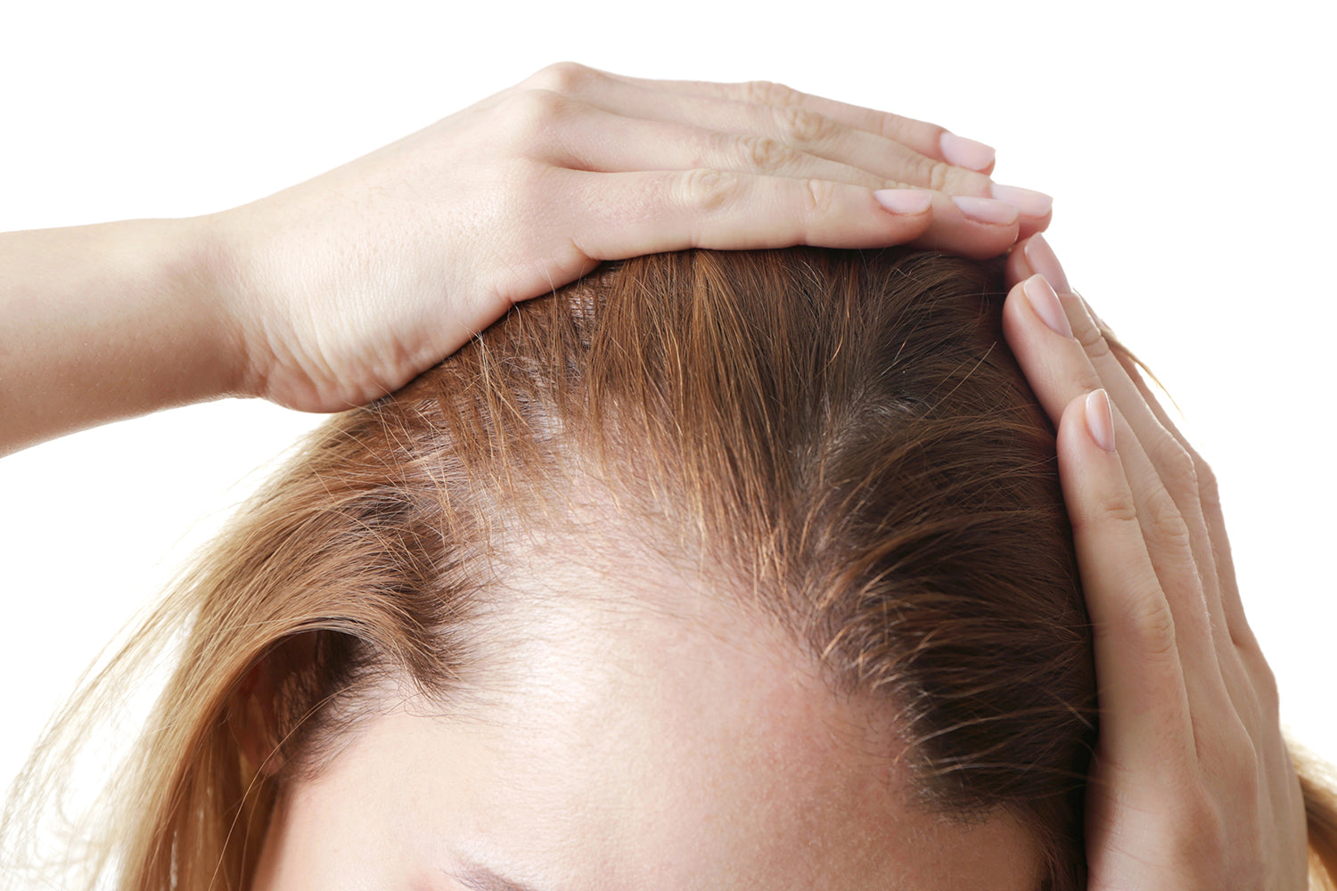 A woman revealing her thinning hairline